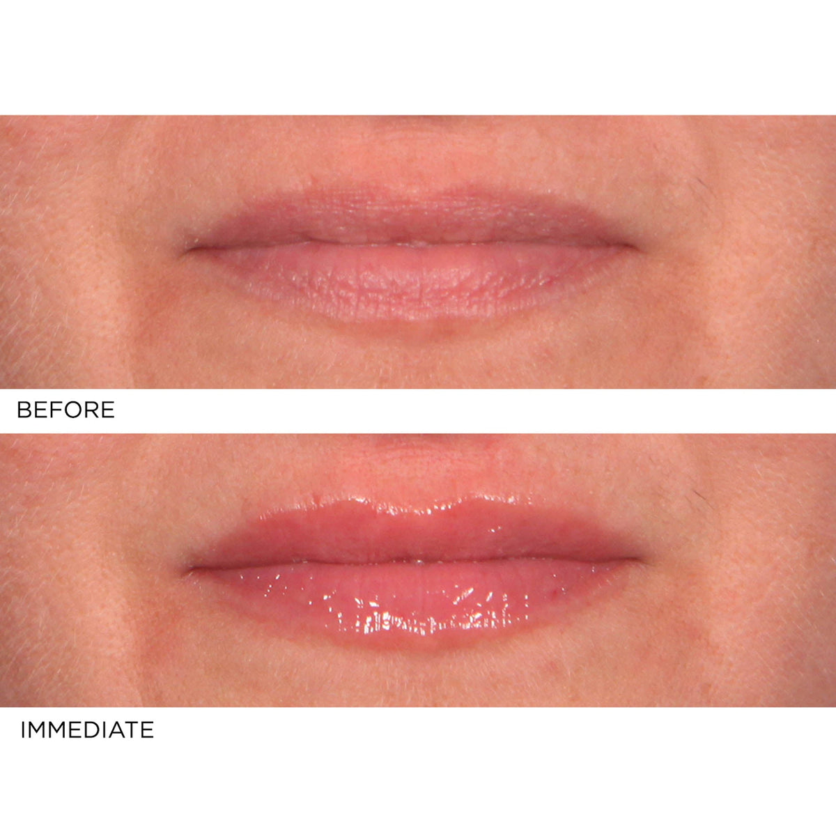Hydro-screen For Lips