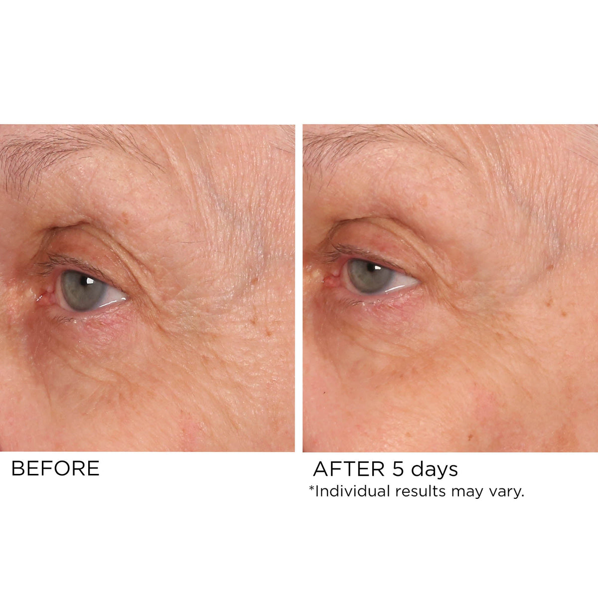 Age Defying Eye Renewal Serum